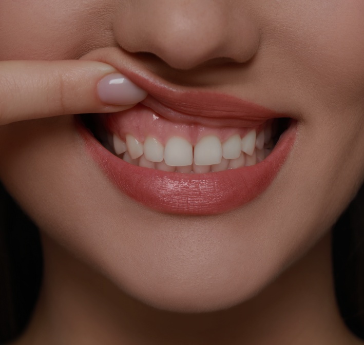 Treatment - Lockswood Dental