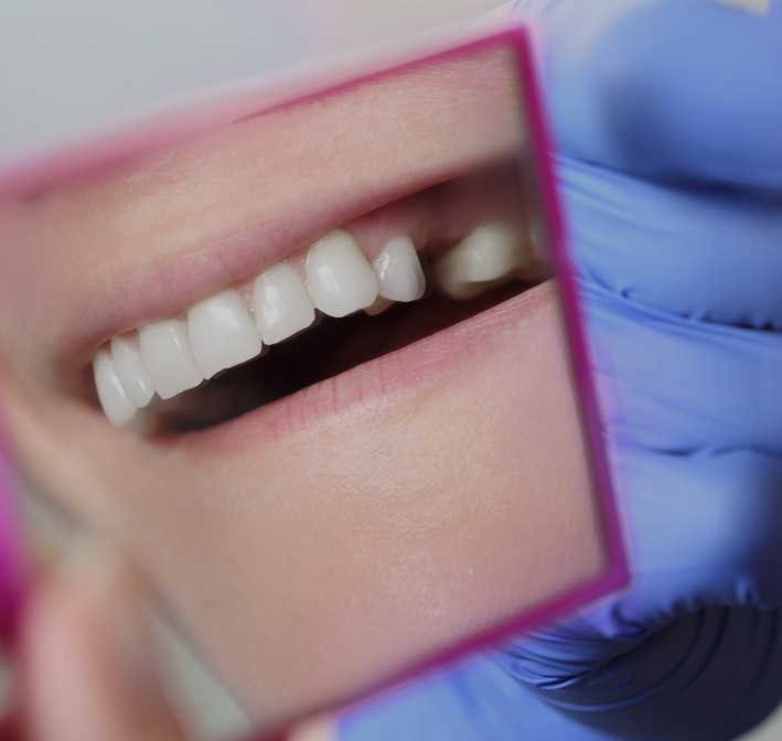 Treatment - Lockswood Dental